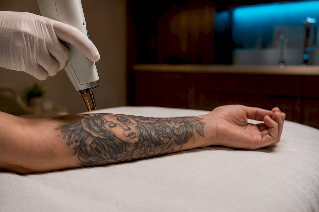 1–2 cm Margin: Clinic Checklist for Laser Hair Removal Near Tattoos